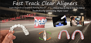 Fast Track Clear Aligners