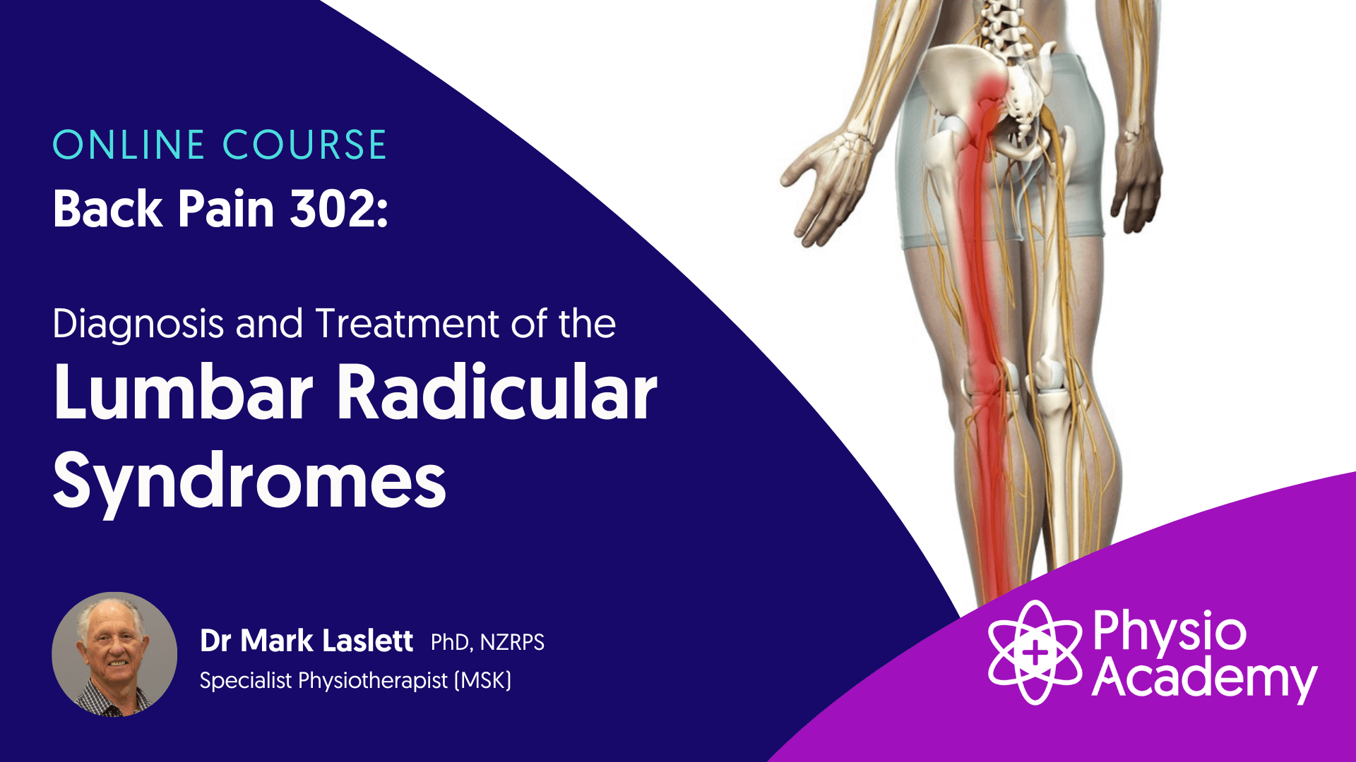 Mark Laslett – Back Pain 302 – Diagnosis and Treatment of the Lumbar Radicular Syndrome (1)